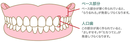 入れ歯の問題 合わない入れ歯を使い続けるとどうなる アールデンタルオフィス